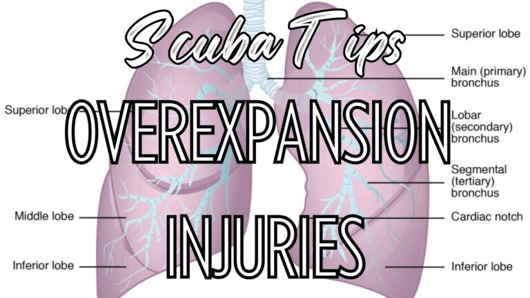 Scuba diving and overexpansion injuries (According to a scuba instructor)
